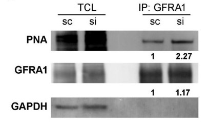 control or ST3GAL1 siRNA were immunoprecipitated with GFRA1 antibody and immunoblotted.jpg